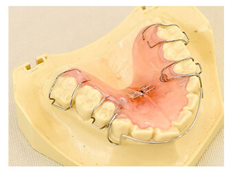 お口の成長に合わせた矯正歯科治療