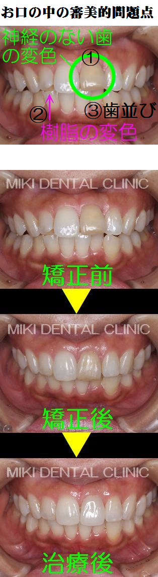 美希デンタルクリニックで治療を体験された皆様 （モニターの方）の